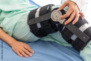 orthopidist adjust angle of knee brace that inserted to the leg of patient after endoscopic surgery for ligament repairing. healthcare and medical concept